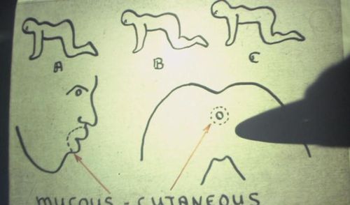 HUMAN CENTIPEDE Diagram HUMAN CENTIPEDE Diagram